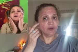 From Glow to Reaction Asma Abbas Warns Against Risky Skin Treatments